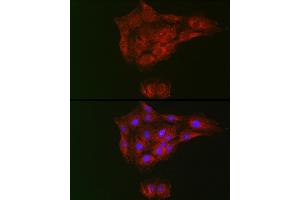 Immunofluorescence analysis of C6 cells using RTKN Rabbit pAb (ABIN6129097, ABIN6147290, ABIN6147292 and ABIN6222455) at dilution of 1:100 (40x lens).