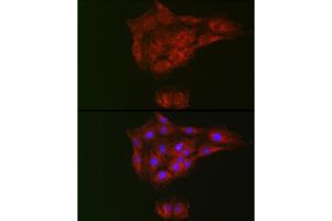 Immunofluorescence analysis of C6 cells using RTKN Rabbit pAb (ABIN6129097, ABIN6147290, ABIN6147292 and ABIN6222455) at dilution of 1:100 (40x lens). (Rhotekin anticorps  (AA 254-513))