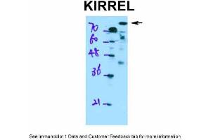 WB Suggested Anti-KIRREL Antibody Titration: 0. (KIRREL anticorps  (Middle Region))