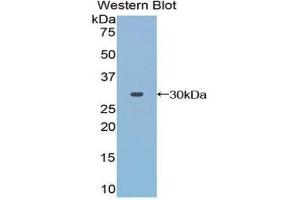 Western Blotting (WB) image for anti-Toll Interacting Protein (TOLLIP) (AA 28-261) antibody (ABIN1860826) (TOLLIP anticorps  (AA 28-261))