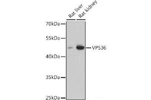 Western blot analysis of extracts of various cell lines using VPS36 Polyclonal Antibody at dilution of 1:3000. (VPS36 anticorps)