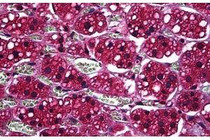 Human Adrenal: Formalin-Fixed, Paraffin-Embedded (FFPE)