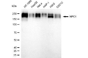 Western blotting analysis using NPC1 antibody (ABIN7799598).