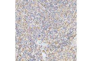 Immunohistochemistry of paraffin-embedded rat spleen using SOCS1 Rabbit pAb (ABIN6128737, ABIN6148263, ABIN6148266 and ABIN6223700) at dilution of 1:250 (40x lens). (SOCS1 anticorps  (AA 1-211))