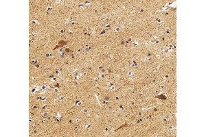 IHC analysis of DLX2 using anti-DLX2 antibody (ABIN7599936). (DLX2 anticorps  (AA 13-310))