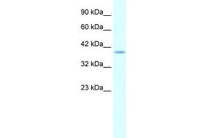 anti-H6 Family Homeobox 1 (HMX1) (Middle Region) antibody
