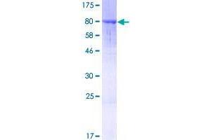 Image no. 1 for Ankyrin Repeat Domain 44 (ANKRD44) (AA 1-579) protein (GST tag) (ABIN1345117)