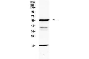 Western blot analysis of GALNS using anti-GALNS antibody . (GALNS anticorps  (AA 181-289))