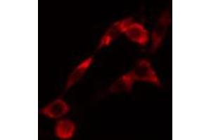 ABIN6274420 staining LOVO cells by IF/ICC. (LMTK2 anticorps  (Internal Region))