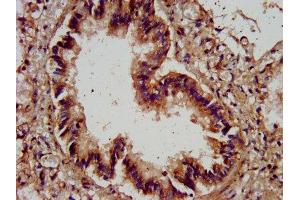 IHC image of ABIN7143601 diluted at 1:400 and staining in paraffin-embedded human lung tissue performed on a Leica BondTM system.