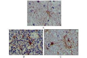 Immunohistochemical analysis of paraffin-embedded human brain tissue (A), lymphoid follicles tissue (B) and interbrain tissue (C), showing cytoplasmic localization using S100A mouse mAb with DAB staining. (S100A1 anticorps)
