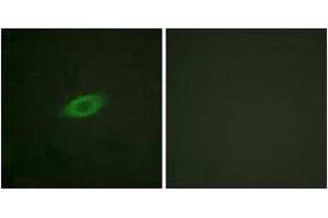 Immunofluorescence analysis of HeLa cells, using Annexin A6 Antibody. (ANXA6 anticorps  (AA 1-50))