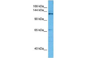 Host:  Mouse  Target Name:  CASZ1  Sample Tissue:  Mouse Pancreas  Antibody Dilution:  1ug/ml (CASZ1 anticorps  (Middle Region))