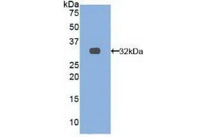 Detection of Recombinant TRAF4, Human using Polyclonal Antibody to TNF Receptor Associated Factor 4 (TRAF4) (TRAF4 anticorps  (AA 193-444))