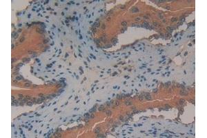 Detection of ANXA2 in Mouse Vas Deferens Tissue using Polyclonal Antibody to Annexin A2 (ANXA2)