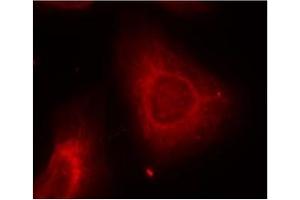 Image no. 2 for anti-Keratin 8 (KRT8) (Ser73) antibody (ABIN197582) (KRT8 anticorps  (Ser73))