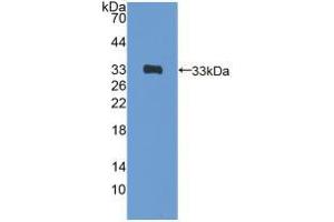 Western blot analysis of recombinant Rat GATA4. (GATA4 anticorps  (AA 228-440))