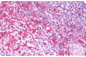 ABIN5539869 (5µg/ml) staining of paraffin embedded Human Spleen. (MIA anticorps  (Internal Region))