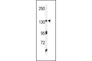 Western blot analysis of ZO1 Antibody (C-term) (ABIN650980 and ABIN2840020) in K562 cell line lysates (35 μg/lane). (TJP1 anticorps  (C-Term))
