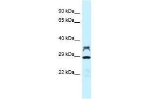 WB Suggested Anti-LOC100362453 Antibody Titration: 1. (LOC100362453 anticorps  (C-Term))