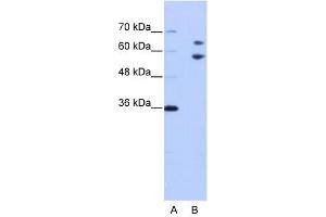 TROVE2 antibody used at 1 ug/ml to detect target protein. (TROVE2 anticorps  (N-Term))