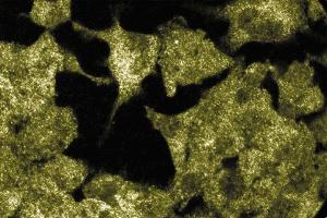 Immunofluorescence staining of PFSK-1 cells (human neuroectodermal tumor line, ATCC CRL-2060).