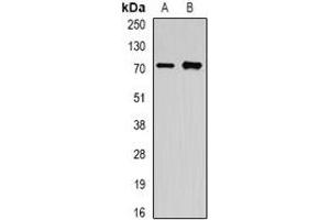 Western blot analysis of OLFM1 expression in A549 (A), mouse brain (B) whole cell lysates. (Olfactomedin 1 anticorps)