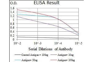 Black line: Control Antigen (100 ng), Purple line: Antigen(10 ng), Blue line: Antigen (50 ng), Red line: Antigen (100 ng), (GUCY1A1 anticorps  (AA 22-214))