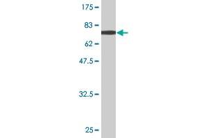 Western Blot detection against Immunogen (70. (Aminoacylase 1 anticorps  (AA 1-408))
