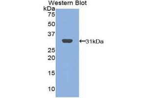 Western Blotting (WB) image for anti-B-Cell Linker (BLNK) (AA 65-314) antibody (ABIN1858143) (B-Cell Linker anticorps  (AA 65-314))