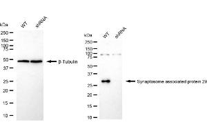 Western blotting analysis using Synaptosome associated protein 29 antibody (ABIN7800488). (Recombinant SNAP29 anticorps)