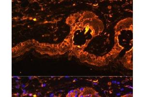 Immunofluorescence analysis of Mouse skin using TYR Polyclonal Antibody at dilution of 1:100. (TYR anticorps)