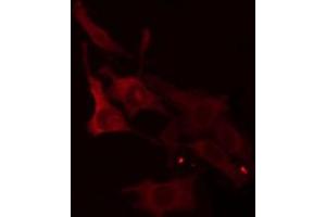 ABIN6266943 staining Hela cells by IF/ICC. (ELOVL1 anticorps  (Internal Region))