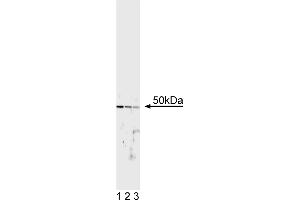 Western Blotting (WB) image for anti-Transcription Factor E3 (TFE3) antibody (ABIN967449) (TFE3 anticorps)