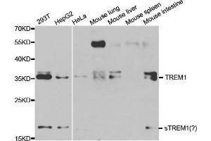 Western blot analysis of extracts of various cell lines, using TREM1 antibody. (TREM1 anticorps  (AA 21-130))