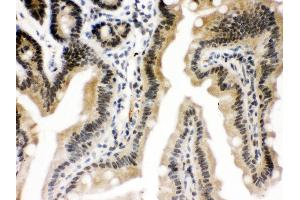 Anti-CTCF Picoband antibody, IHC(P) IHC(P): Mouse Intestine Tissue