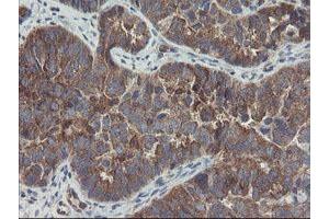 Image no. 4 for anti-Copper Metabolism (Murr1) Domain Containing 1 (COMMD1) antibody (ABIN1497563)