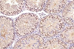 Immunohistochemistry analysis of paraffin-embedded mouse testis using,PARC (ABIN7073606) at dilution of 1: 1200