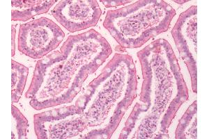 Human Small Intestine: Formalin-Fixed, Paraffin-Embedded (FFPE)
