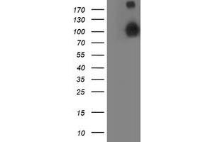 HEK293T cells were transfected with the pCMV6-ENTRY control (Left lane) or pCMV6-ENTRY ANAPC2 (Right lane) cDNA for 48 hrs and lysed. (ANAPC2 anticorps)