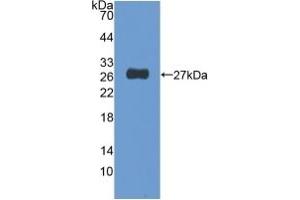 Detection of Recombinant NUP155, Human using Polyclonal Antibody to Nucleoporin 155 (NUP155) (NUP155 anticorps  (AA 1154-1379))