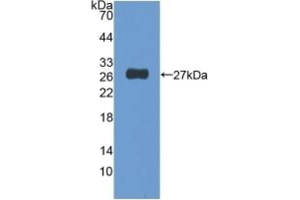 NUP155 Antikörper  (AA 1154-1379)