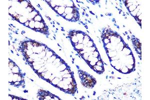 Immunohistochemistry of paraffin-embedded human colon using PDK2 Rabbit mAb (ABIN7269773) at dilution of 1:100 (40x lens).
