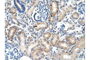 Image no. 1 for anti-Mucin 1 (MUC1) (C-Term) antibody (ABIN6736343)