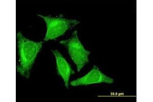 Image no. 3 for anti-RasGEF Domain Family, Member 1C (RASGEF1C) (AA 168-261) antibody (ABIN599341) (RASGEF1C anticorps  (AA 168-261))