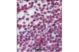 Formalin-fixed and paraffin-embedded human Spleen tissue reacted with Cdc25A Antibody (Center) (ABIN390214 and ABIN2840696) , which was peroxidase-conjugated to the secondary antibody, followed by AEC staining.