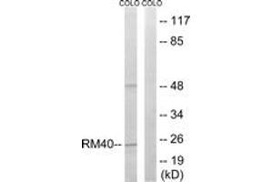 Western blot analysis of extracts from COLO cells, using MRPL40 Antibody. (MRPL40 anticorps  (AA 101-150))