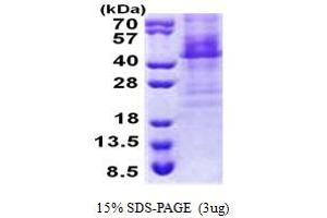 SDS-PAGE (SDS) image for Homeobox C11 (HOXC11) (AA 1-304) protein (His tag) (ABIN5853170) (HOXC11 Protein (AA 1-304) (His tag))