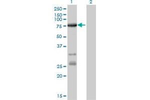 Western Blotting (WB) image for anti-Acyl-CoA Synthetase Long-Chain Family Member 5 (ACSL5) (AA 91-187) antibody (ABIN599251)