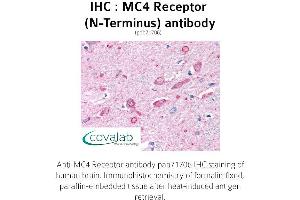 Image no. 1 for anti-Melanocortin 4 Receptor (MC4R) (Extracellular Domain), (N-Term) antibody (ABIN1736808)